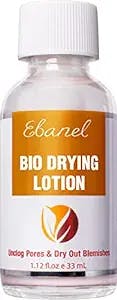 Ebanel Acne Drying Lotion, Overnight Salicylic Acid and Sulfur Cystic Acne Spot Treatment for Face and Body, Pimple Cream Spot Treatment, Dries Out Pimples, Cysts, Blemishes, Zits, and Clogged Pores