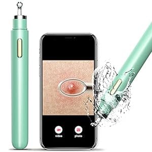 womfenn Visible Blackhead Remover[2022 New], Advanced Pimple Popper with Camera Acne Comedone Whitehead Extractor Kit Pore Blemish Removal Tools, 20X Zoom, Compatible with iPhone & Android, iPad