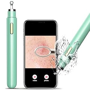 Glow Up Your Skin with womfenn Visible Blackhead Remover - The Ultimate Pim