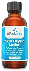 Drying Lotion - Alcohol-Free Overnight Acne & Whitehead Spot Treatment – Fights Blemishes, Pimples & Breakouts for a Clear Skin – Fast Acting Formula with Sulfur & Salicylic Acid - 1 fl oz