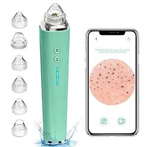 Blackhead Remover Review: Pimple Poppin' Just Got High Tech