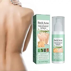 Get ready to say goodbye to those pesky zits on your back, butt, and thighs