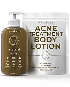 Ayadara Anti-Acne Treatment Body Lotion | Pimple Cream with Salicylic Acid, Tea Tree, & Aloe Vera | Chest, Arm, Shoulder, Thigh, Butt, & Back Acne Treatment for Women, Men, & Teens | 75-Day Supply