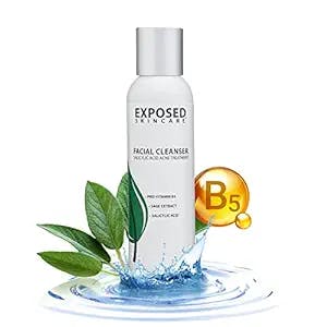 TheAcneList.com Reviews Exposed Skin Care Acne Facial Cleanser - The Soluti