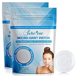 Acne Pimple Micropoint Patches with 173 Micropoints (18 count/2 packs) - Best Acne Spot Treatment for Inflamed, Cystic, Hormonal Zits, Breakouts, Blemish