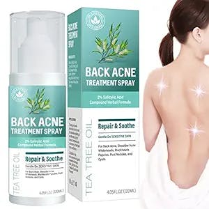 Back Acne Treatment, Body Acne Treatment Spray, Hormonal Acne Treatment with Natural Formula, Gentle on Skin, 4.05 fl.oz