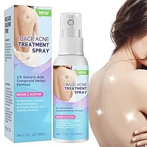 EFINITYER Back-Acne-Treatment, Acne Spot Treatment, 2% Salicylic Acid Acne Spray for Back and Shoulder, Smooth