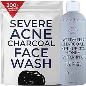 AYADARA Cystic, Hormonal, & Severe Acne Charcoal Face Wash | Prevents Future Breakouts, Inflamed Pores, & Dark Spots | Deep Cleansing Sulfur Acne Facial Cleanser for Oily & Sensitive Skin | 200+ Uses