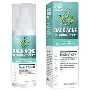 Zap Your Zits with Back-Acne-Treatment Body-Acne-Treatment-Spray: The Natur