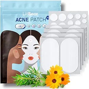 LitBear Acne Pimple Patches, 5 Sizes 80 Patches for Large Zit Breakouts, Acne Patches for Face, Chin or Body, Acne Spot Treatment with Tea Tree & Calendula Oil, Hydrocolloid Bandages for Acne Skin