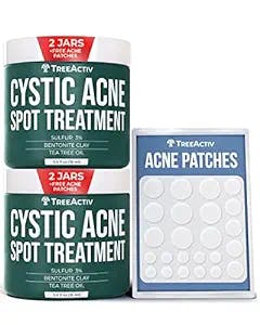 Cystic Acne Spot Treatment, 2 pack, 240+ Uses, Overnight Results Cystic Acne Treatment Unique Formula with Sulfur, Bentonite, & Tea Tree Oil, Works on Hormonal & Stubborn Acne, Cystic Acne, & Blackheads, by TreeActiv