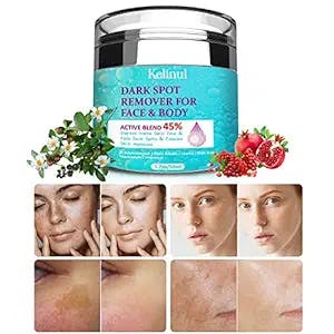 Dark Spot Corrector Remover for Face and Body, Formulated with Advanced Ingredient 4-Butylresorcinol, Kojic Acid, Lactic Acid and Salicylic Acid (60)