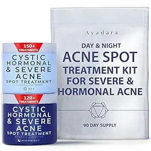 Day & Night Cystic Spot Treatment Kit, Daytime Salicylic Acid Spot Treatment Cream & Overnight Sulfur Cystic Acne Spot Treatment for Hormonal & Severe Acne, by Ayadara