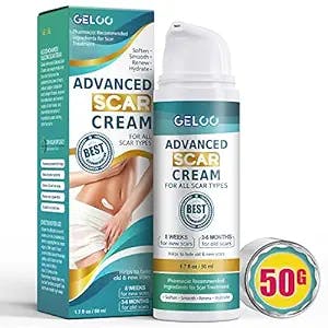 Acne Sufferers Rejoice! Geloo Scar Cream is Here to Save the Day!