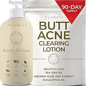 Get Your Bootylicious Skin Back with Ayadara Butt Acne Clearing Lotion!