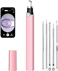Blackhead Remover Tools with Camera, Visible Blackhead Remover, Pimple Popper Comedone Whitehead Extractor Kit, 20X Magnification Visible Pore Cleaner Compatible with iPhone, iPad & Android