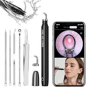 YUYUKO Blackhead Remover Tools, Pimple Popper Tool Kit, Visible Pore Cleaner with Ultra HD Camera and Lights, Rechargeable, Comedones Blackhead Extractor Tool for iPhone, iPad & Android Smart Phones